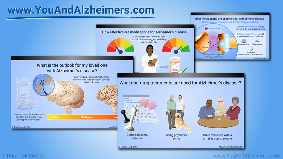Slide Show - Managing and Treating Alzheimer's Disease