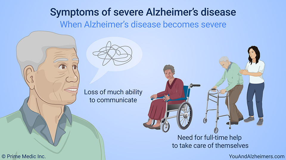 Symptoms of severe Alzheimer's disease – When Alzheimer's disease becomes severe