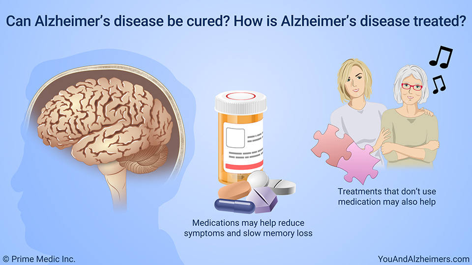 Can Alzheimer's disease be cured? How is Alzheimer's disease treated?