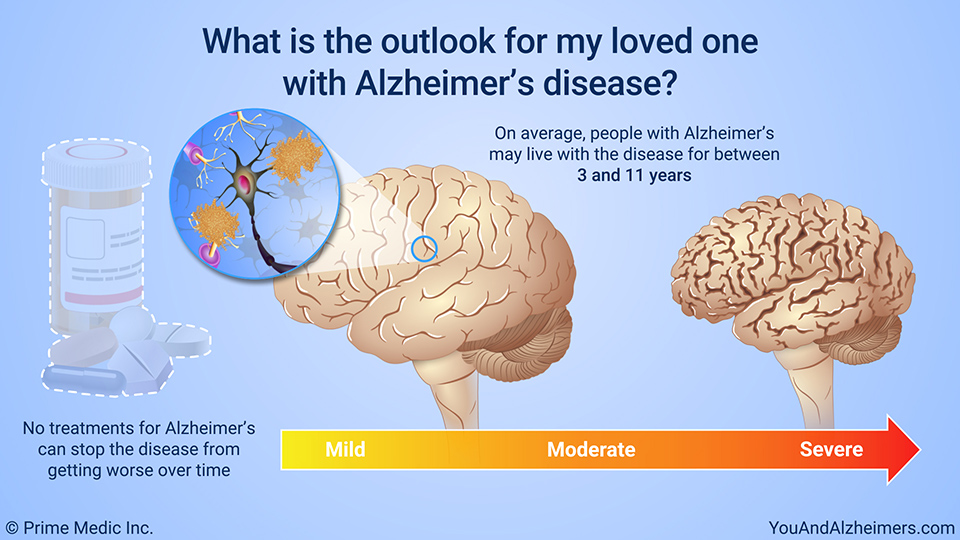 What is the outlook for my loved one with Alzheimer's disease?