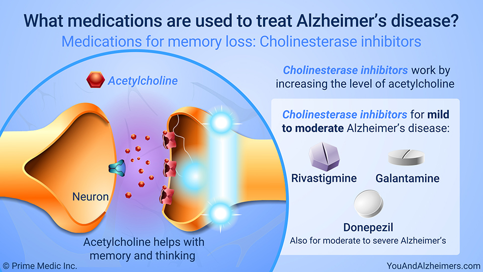 What medications are used to treat Alzheimer's disease? – Medications for memory loss: Cholinesterase inhibitors
