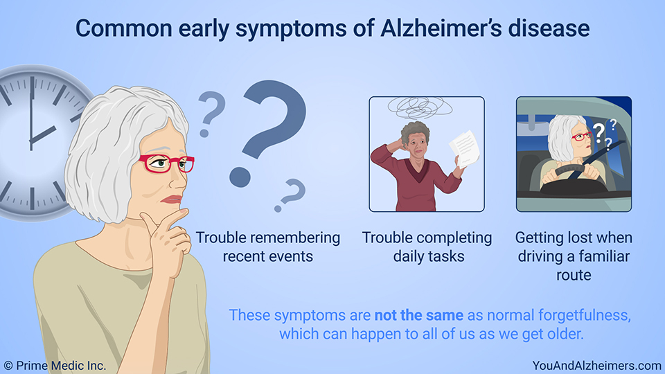 Common early symptoms of Alzheimer's disease