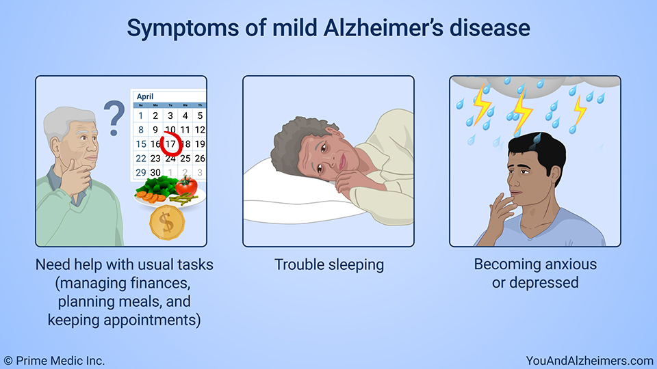 Symptoms of mild Alzheimer's disease