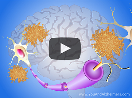 Learn about a variety of topics on Alzheimer's disease through short animations.